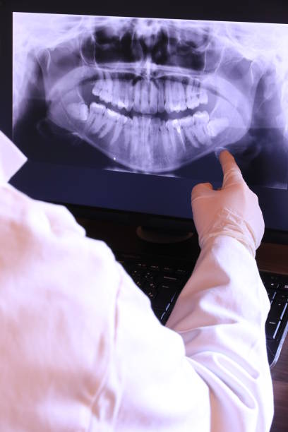 Best Emergency Tooth Extraction in Desert Hills, AZ